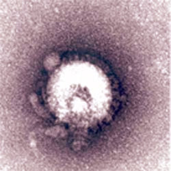 virus_bird_flu_h5n1.jpg